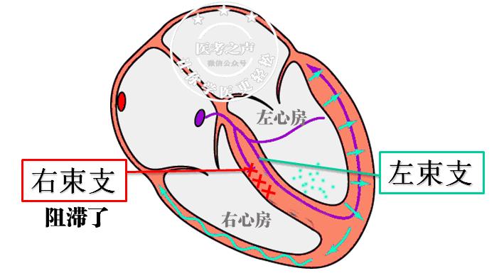 心电图秒懂,心电图零基础都秒懂