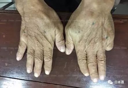 日本山口组在泰国落网,日本山口组最大头目