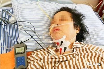 「专业」脑干梗塞合并吞咽障碍，脑病科吞咽专科护士有妙招