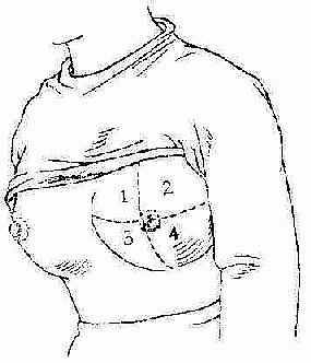 好险！谁说小乳房患癌易发现？这里有一个差点漏诊的病例