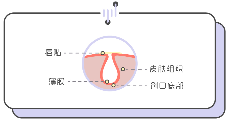 手把手教你正确挤痘不留坑,挤痘挤了个坑
