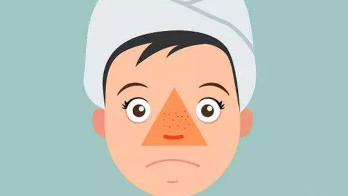 手把手教你正确挤痘不留坑,挤痘挤了个坑