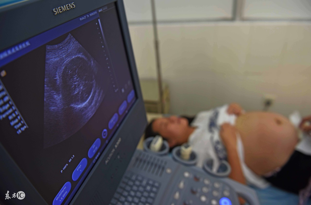 大排畸胎儿偏大怎么办,双胎大排畸不配合怎么趴