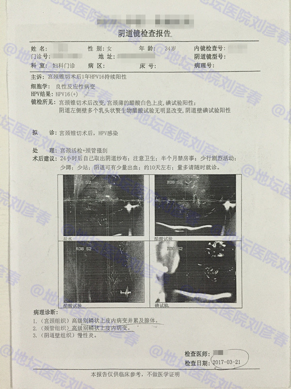 宫颈锥切后新感染hpv53型,宫颈活检低度病变hpv感染