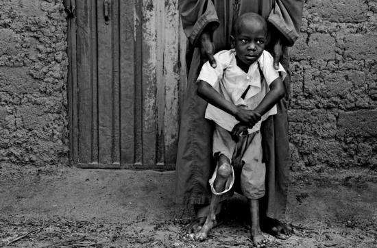 可能是2018年最重要的一件事之一：脊髓灰质炎或被彻底消灭