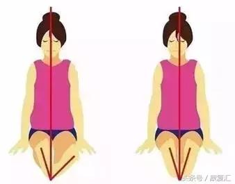 怎么矫正不良身姿,腰椎侧弯骨盆倾斜可以矫正过来吗