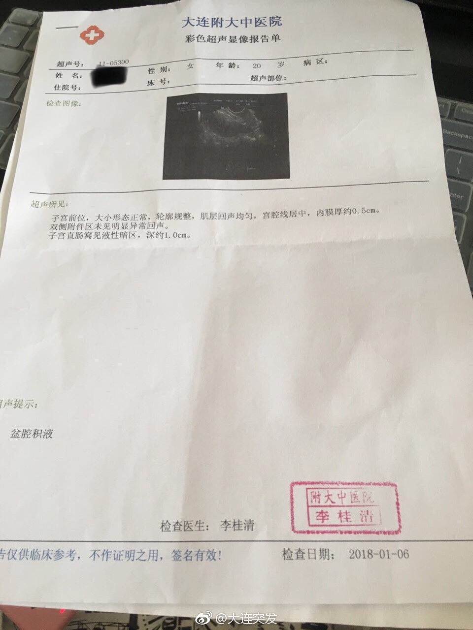 做一次妇检需要多少钱,做个妇科检查花了两千多