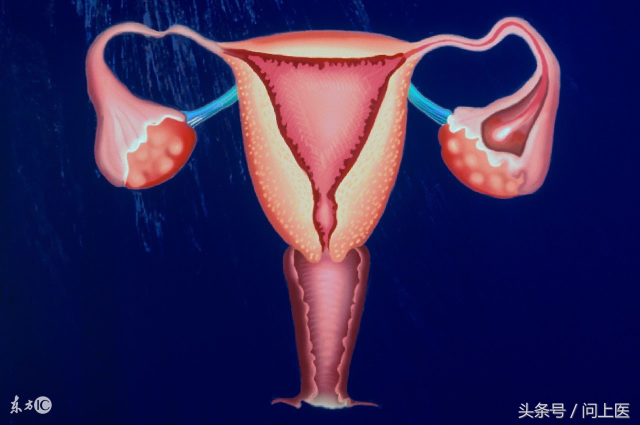 达英35治疗多囊卵巢还会避孕嘛,多囊卵巢吃达英35要避孕吗