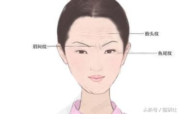 注射除皱案例,了解如何注射除皱