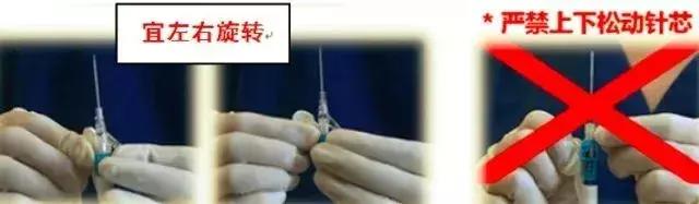 留置针断裂如何发现,留置针断裂入血管的处理方法