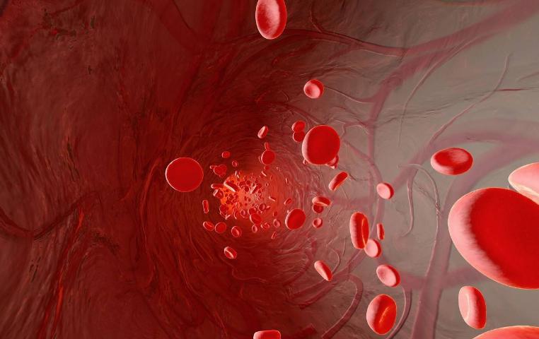 地中海贫血症的原因,地中海贫血基因治疗最新进展