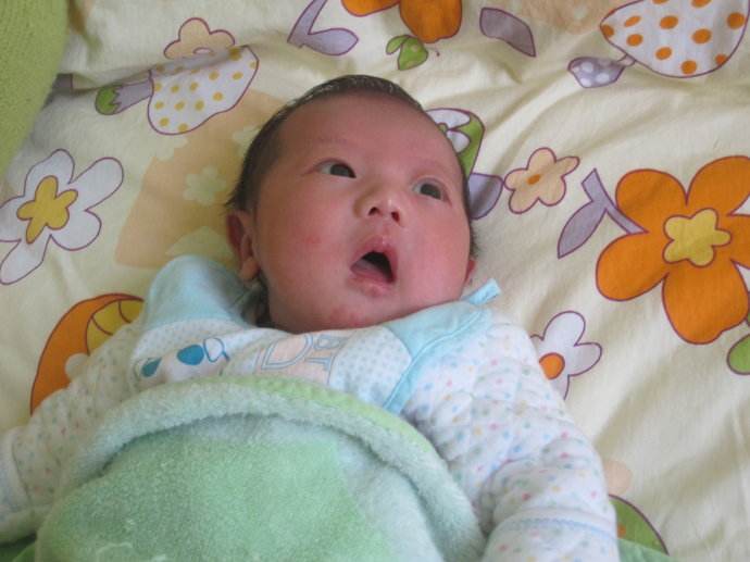 小孩脸上长湿疹是什么原因引起的,小湿疹一般是由什么原因引起的