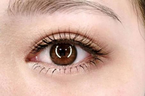 为什么人人都说单眼皮比双眼皮丑,单眼皮就是长得不好看吗