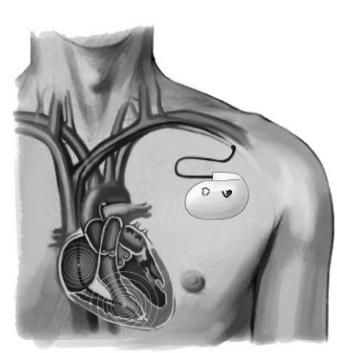 心脏扩大了现在又不大了,心脏增大不管它会怎样