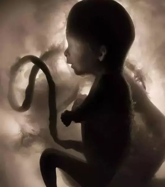 月安馨小课堂“羊水”为什么叫羊水呢？