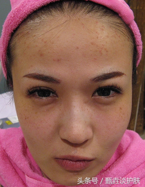 肤色黑黄不均匀怎么办,身上肤色不均匀暗黄怎么改善