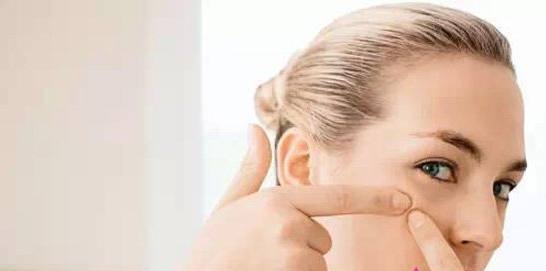 黑色痘印变成红褐色痘印,黑色痘印快速消除药膏