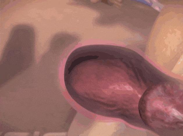 生孩子产程过长,生孩子顺产全产程最快要多久