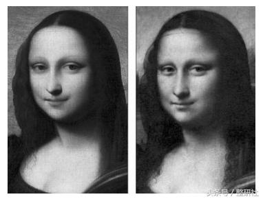 prp面部抗衰真的有效果吗,prp面部抗衰到底有没有效果