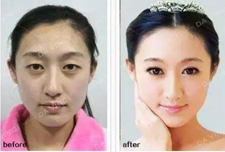 “隔夜脸”丧丧的？最有效补水方式，看这里！