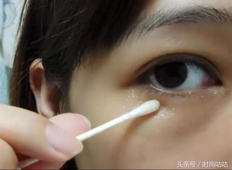 有眼袋怎么消除请问专家,有眼袋怎么消除不用任何物品