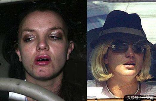 吸毒的人眼睛有什么特征,吸毒的人眼睛是什么样特征