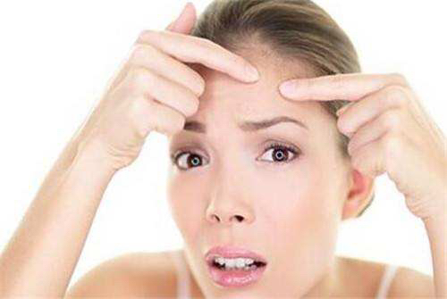 额头爱长痘痘的人怎么调理,额头间长痘痘怎么办