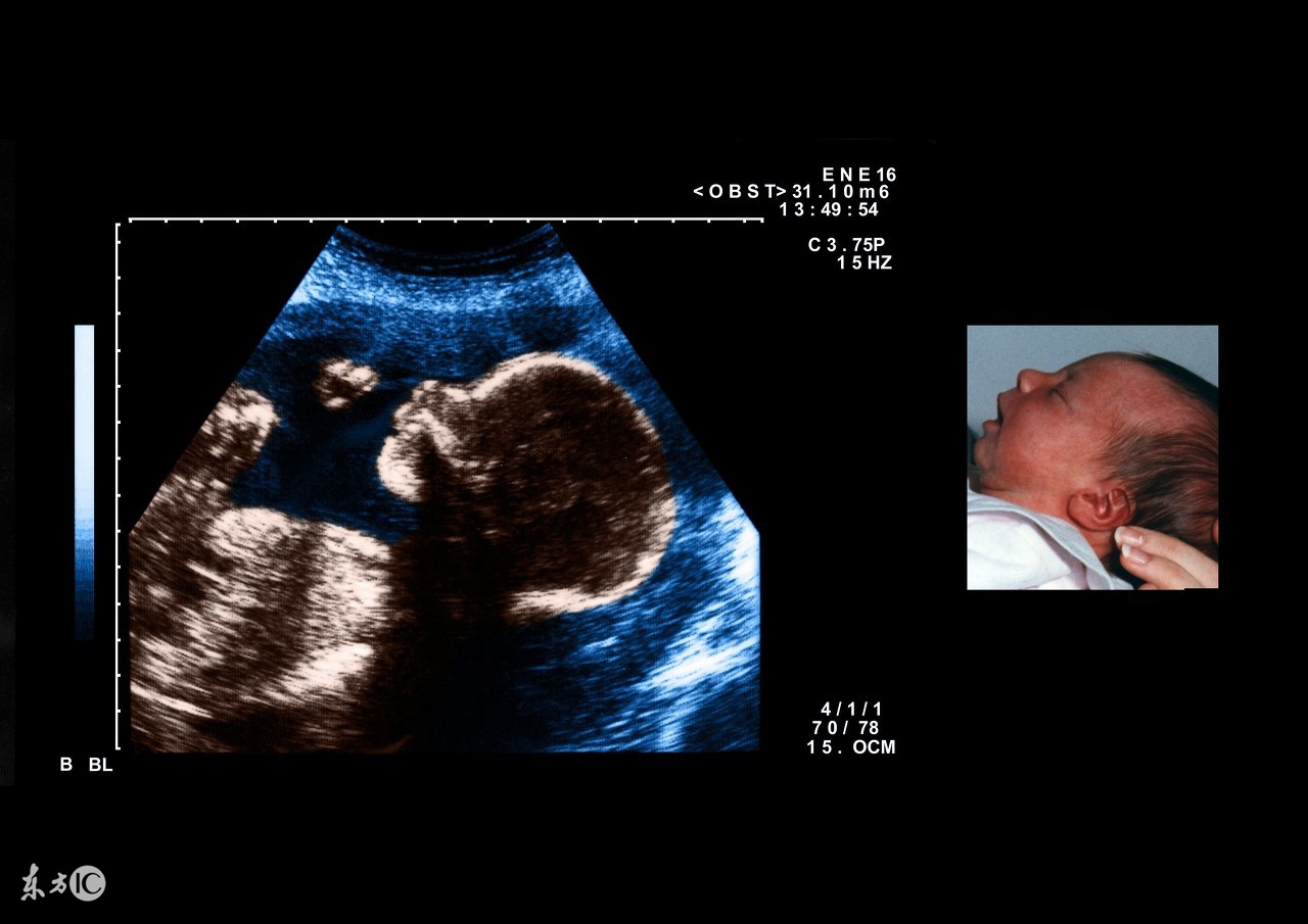 备孕妈妈早孕反应该怎么控制,备孕女人老是自动流产