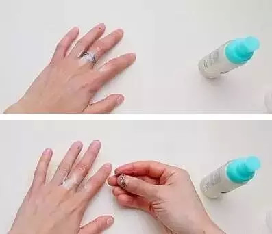 戒指卡在手上怎么去掉,戒指卡在手里拿不出来怎么办