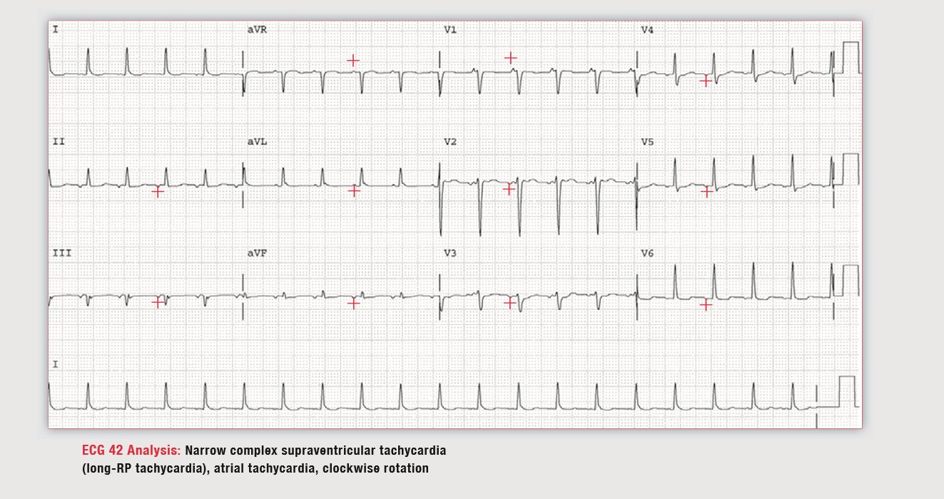 读心有术30秒,读心有术