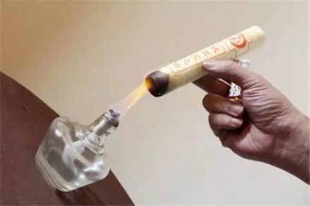 艾灸八髎穴的功效和好处,人体穴位艾灸大全