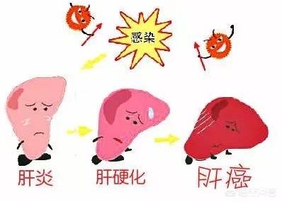 转氨酶高血脂高要关注什么,转氨酶高关注吃什么食物好