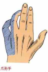 长途骑行手指无力,长途骑行手腕疼怎么办