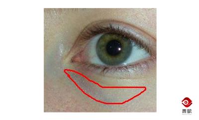 戴眼镜看字有重影是什么原因,戴眼镜重影是什么原因