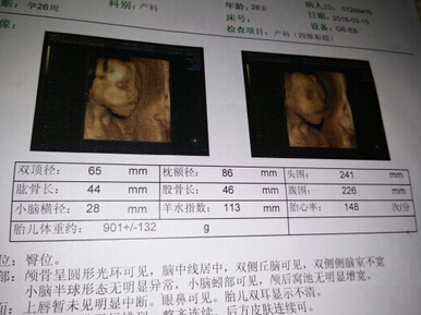 b超对身体危害大吗,b超对身体有什么危害
