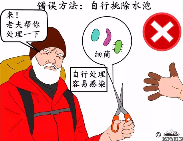 登山晒伤了怎么办,登山8000米冻伤手指
