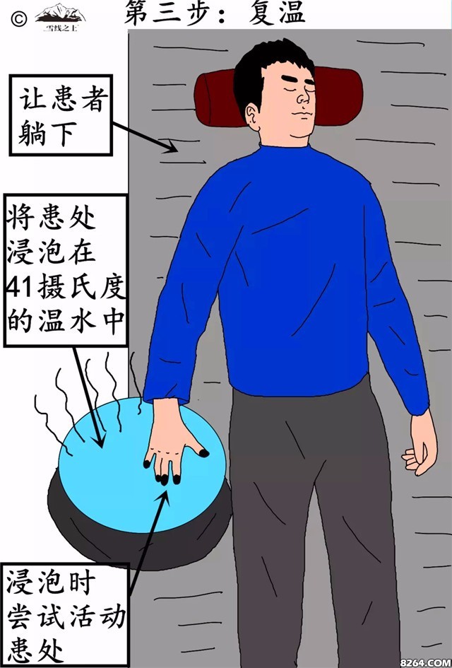 登山晒伤了怎么办,登山8000米冻伤手指