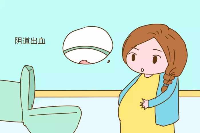 孕期一定要关注这些早产征兆，预防更重要！