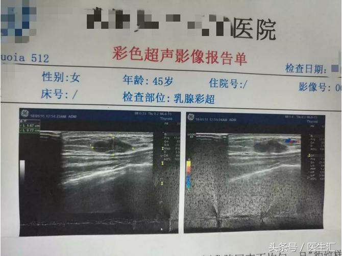 乳房包块是结节吗,乳房包块怎么引起的