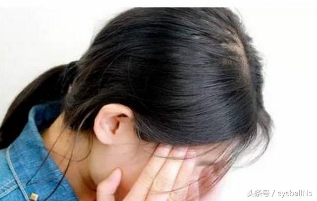 你以为只有喝酒、吵架才会脸红脖子粗，其实跑步也会！