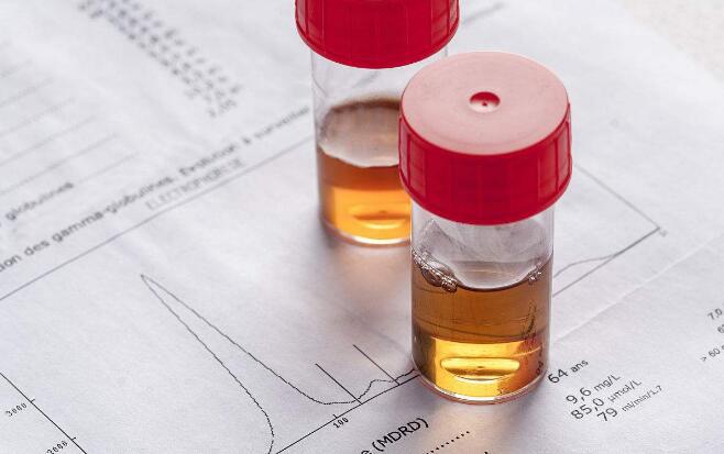 肾病尿蛋白3+西医如何治疗,膜性肾病尿蛋白3个加能痊愈么