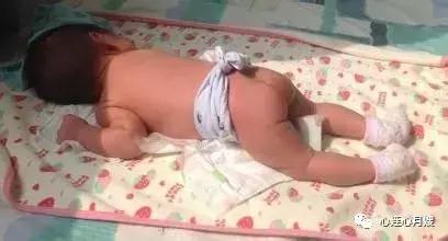 新生儿晒太阳退黄方式,宝宝黄疸高晒太阳有点发热怎么办