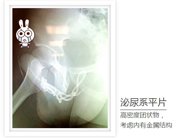 一根火柴引发的血案,一根线引发的惨案