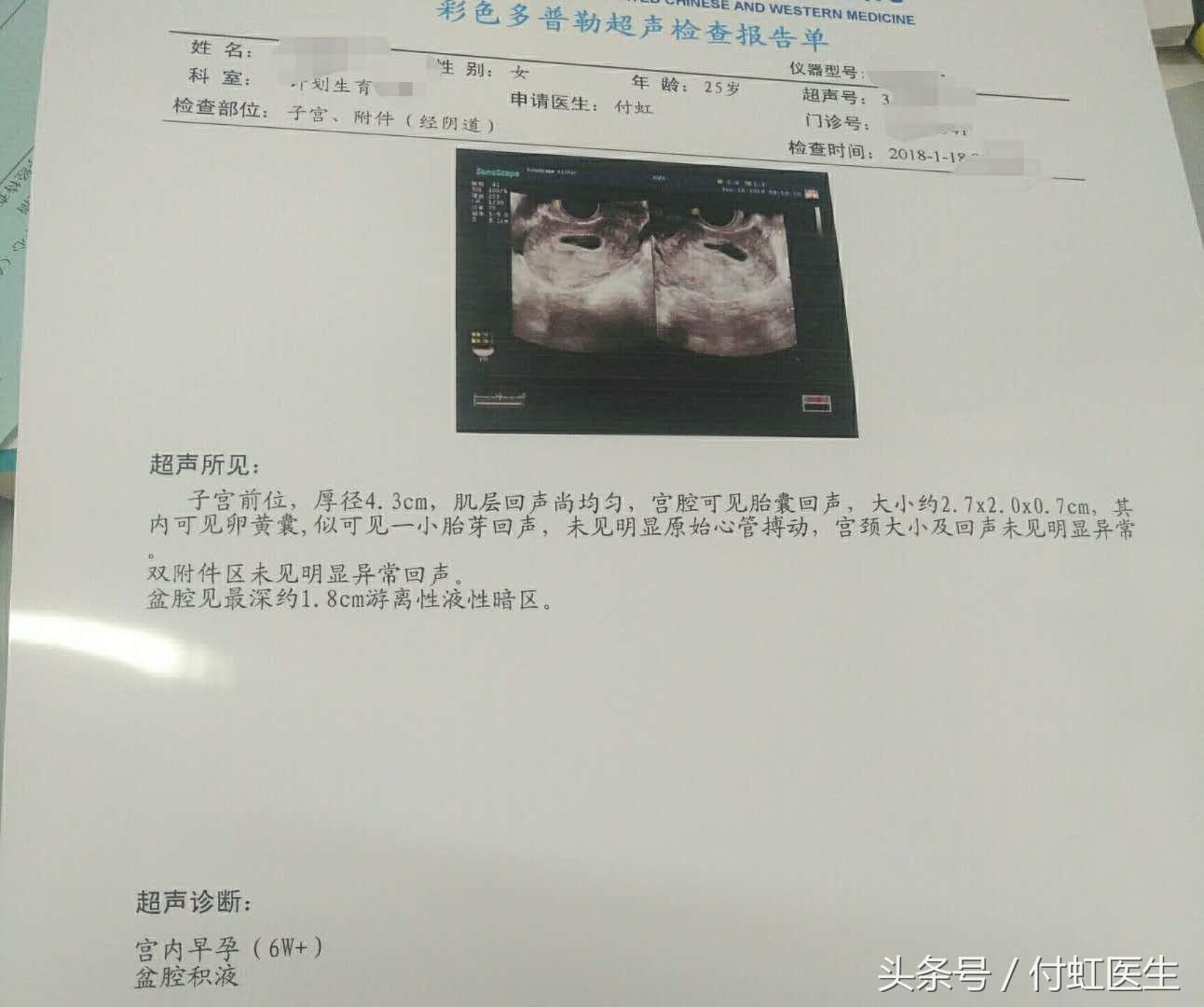 吃了左氧氟沙星结果怀孕了能要吗,左氧氟沙星吃了发现怀孕了能要吗