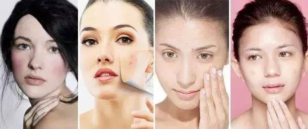 敏感肌冬季护理小常识,敏感肌的春季防敏攻略来咯