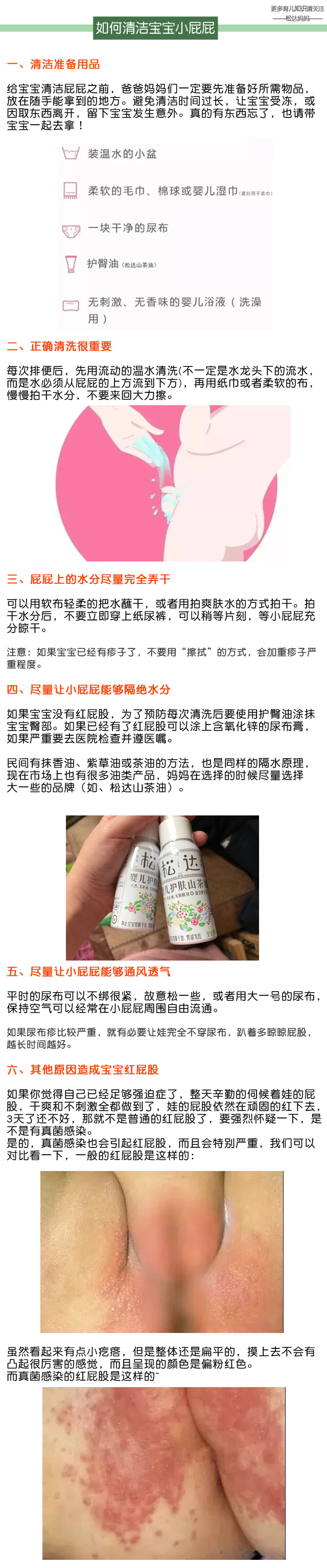 宝宝红屁股怎么处理的,宝宝红屁股反反复复怎么办