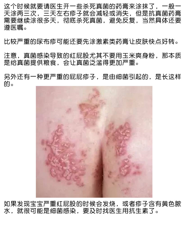 宝宝红屁股怎么处理的,宝宝红屁股反反复复怎么办