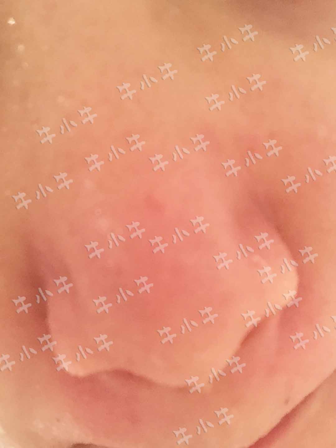 没有Luna这一步，后续的护肤不都白做了吗？