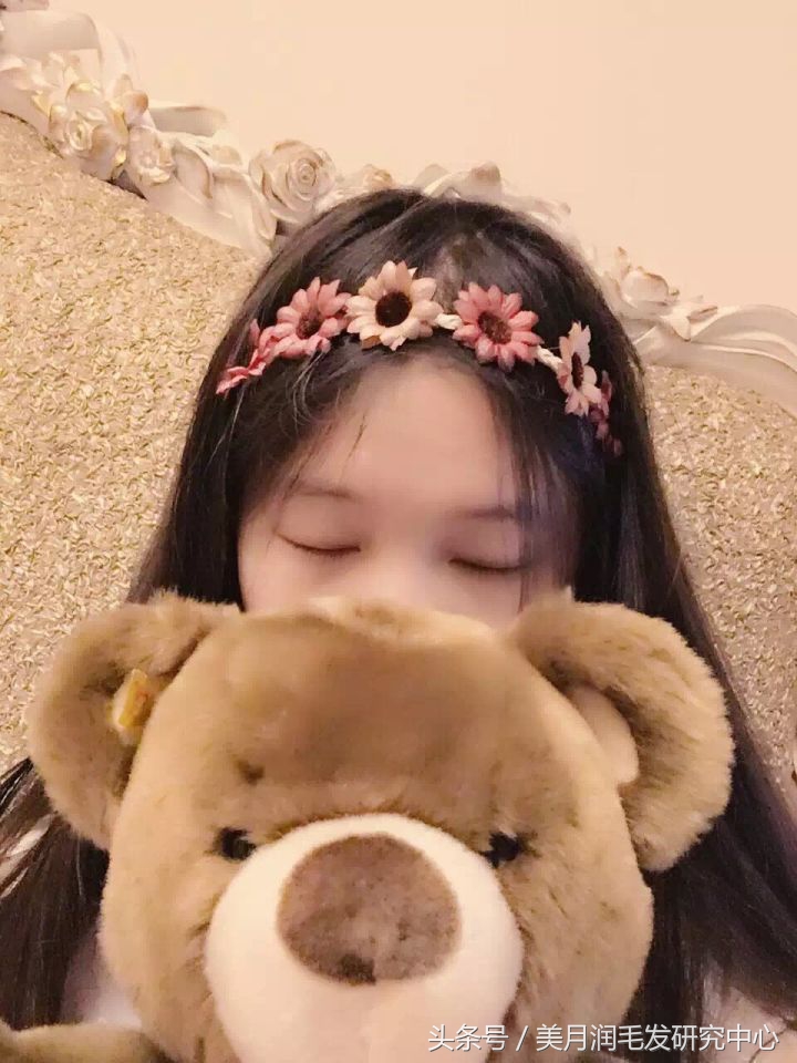 头发少发际线高怎么扎高马尾,发际线高怎么拯救头发少