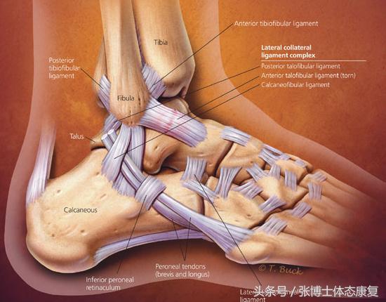 崴脚怎么避免习惯性扭伤,踝关节扭伤一直崴脚怎么办